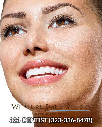 VENEERS DENTIST LOS ANGELES SMILE
